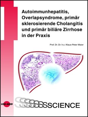 cover image of Autoimmunhepatitis, Overlapsyndrome, primär sklerosierende Cholangitis und primär biliäre Zirrhose in der Praxis